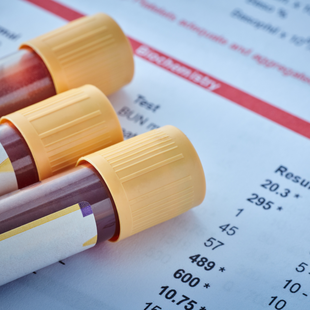 Blood Tests